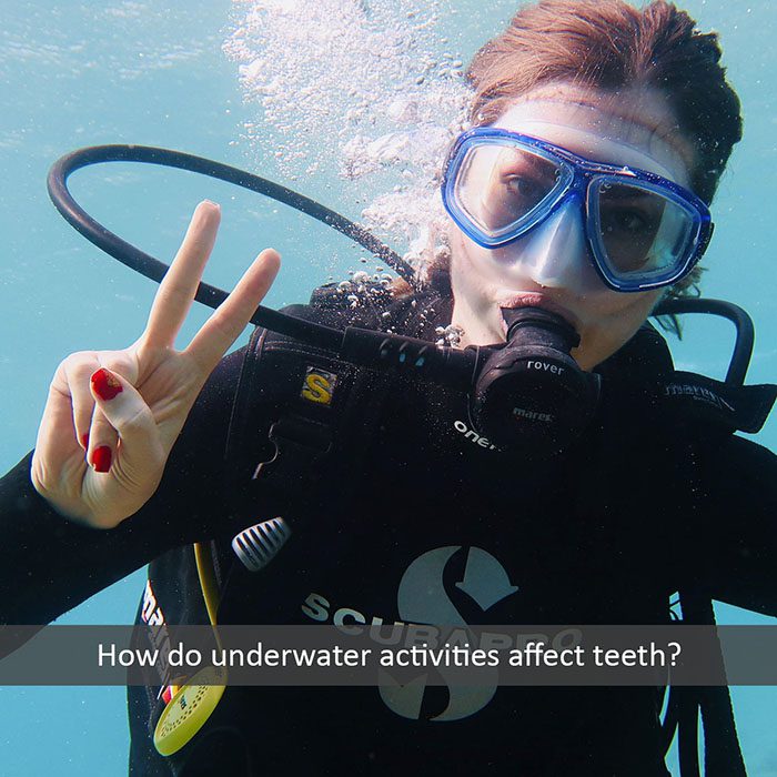 underwater teeth 2022 700 Watkin Dental Associates