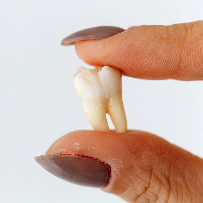 baby teeth traditions 2023 700 Watkin Dental Associates